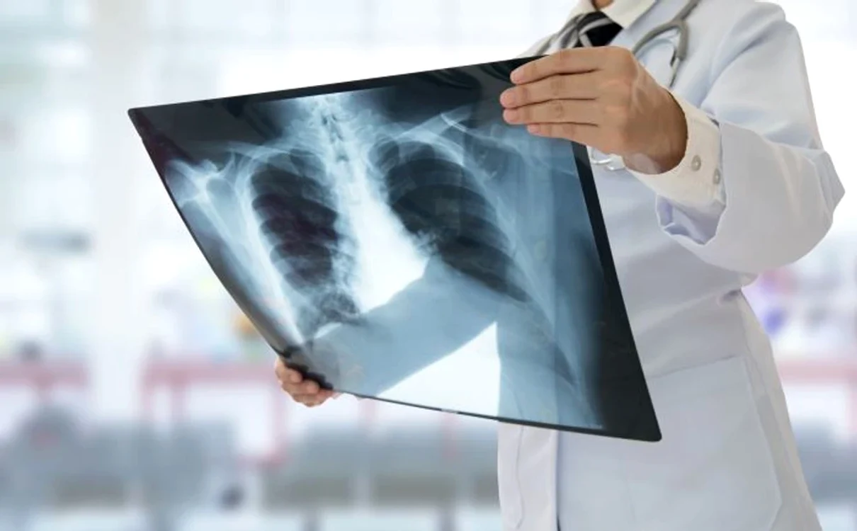 Ai plămânii plini de toxine? Planta banală care îi curăță imediat: Rezultatele te vor uimi!