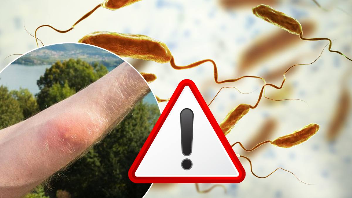 Alertă pe litoralul european! Bacteria „mâncătoare de carne” se extinde rapid: Pericolul uriaș la care se expun toți turiștii!