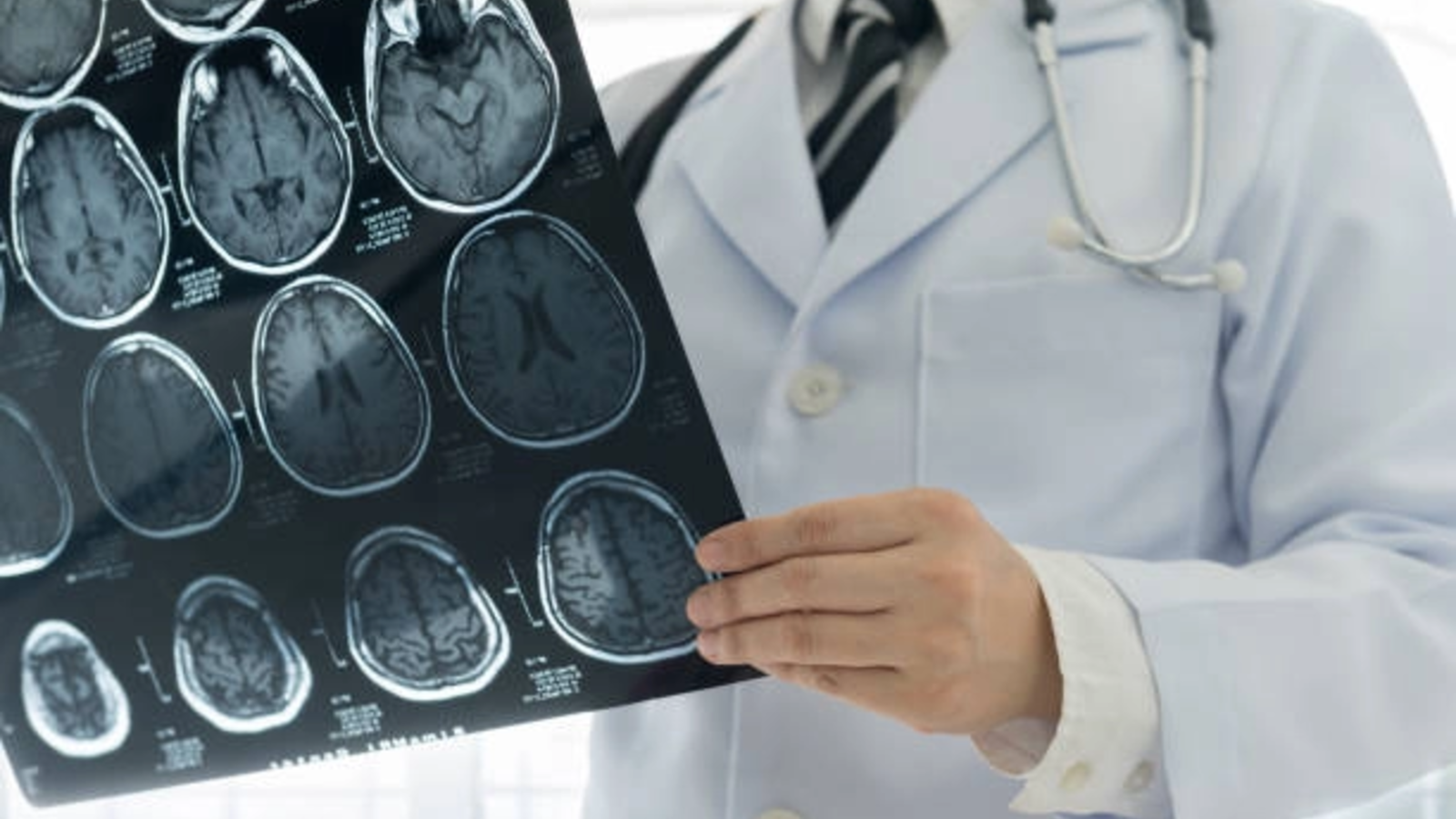 ALERTĂ! AVERTISMENT SUMBRU pentru tineri! Boala TERIBILĂ care a explodat la cei sub 50 de ani: ce au descoperit MEDICII! 